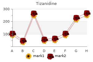 buy generic tizanidine line