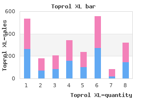 cheap 100mg toprol xl with amex