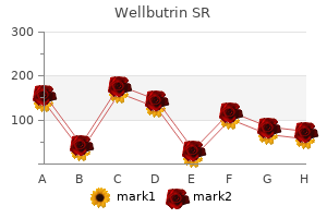 discount wellbutrin sr 150 mg